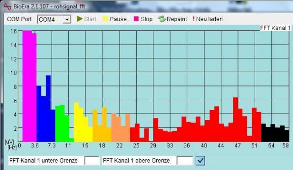 Verteilung von Gehirnfrequenzen im EEG