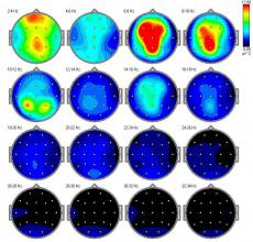 EEG-Brainmap