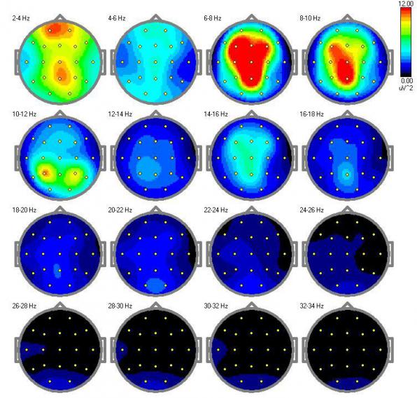 EEG-Brainmap